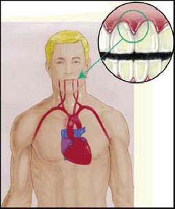 Illustrating the link between dental and heart health